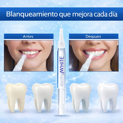WhiteAge™ - Blanquea manchas visibles sin sensibilidad dental