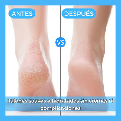 HeelCare Plus™ – Alivio inmediato del dolor y grietas en tus talones